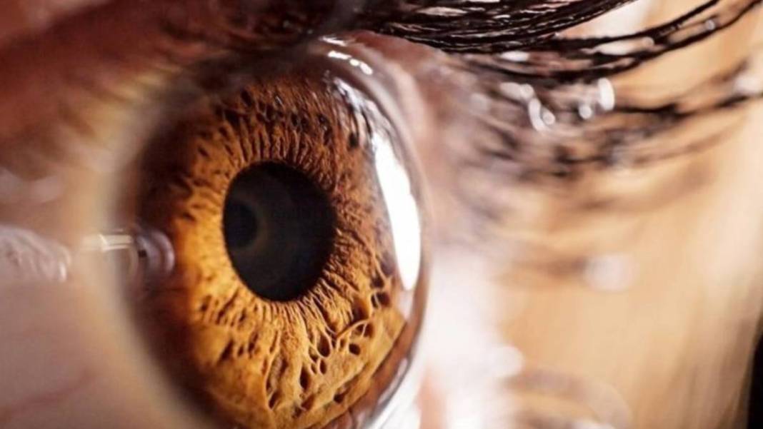 Gözünüz renkliyse dikkat! Büyük sır ortaya çıktı: Meğer o genetik özellik... 4